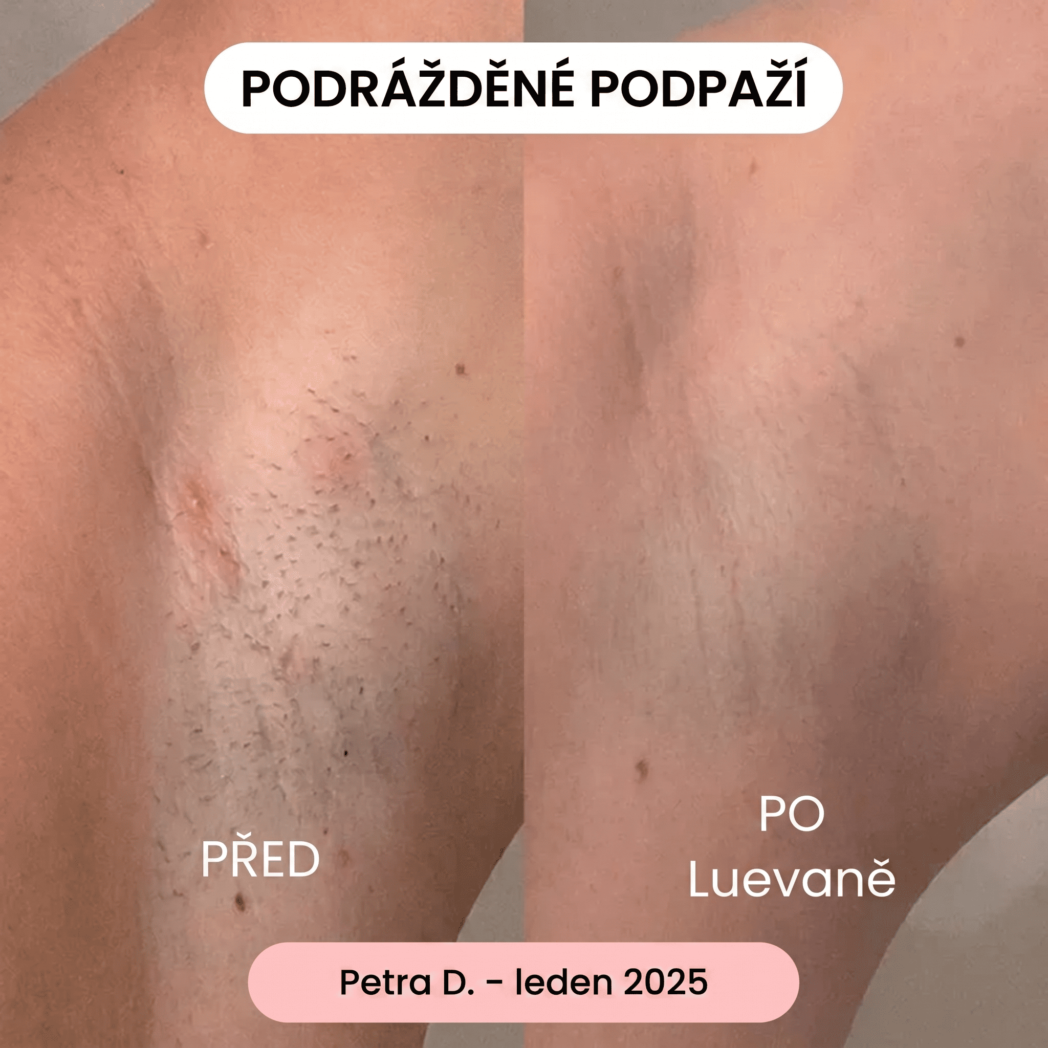  Translation missing: cs.placeholder.placeholder_image_alt