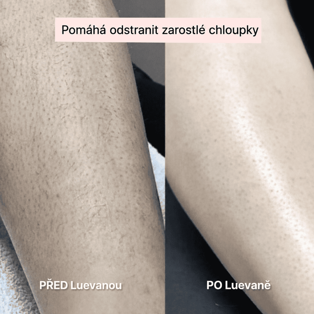 Luevana™ – Dámský holicí strojek 2 v 1