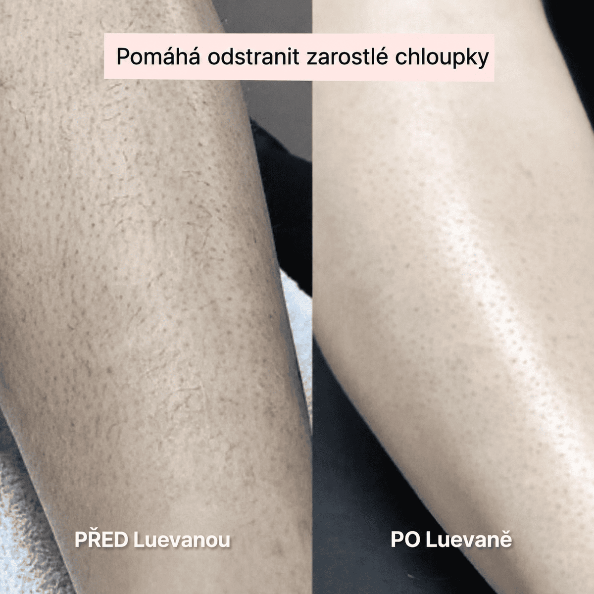 Luevana™ – Dámský holicí strojek 2 v 1