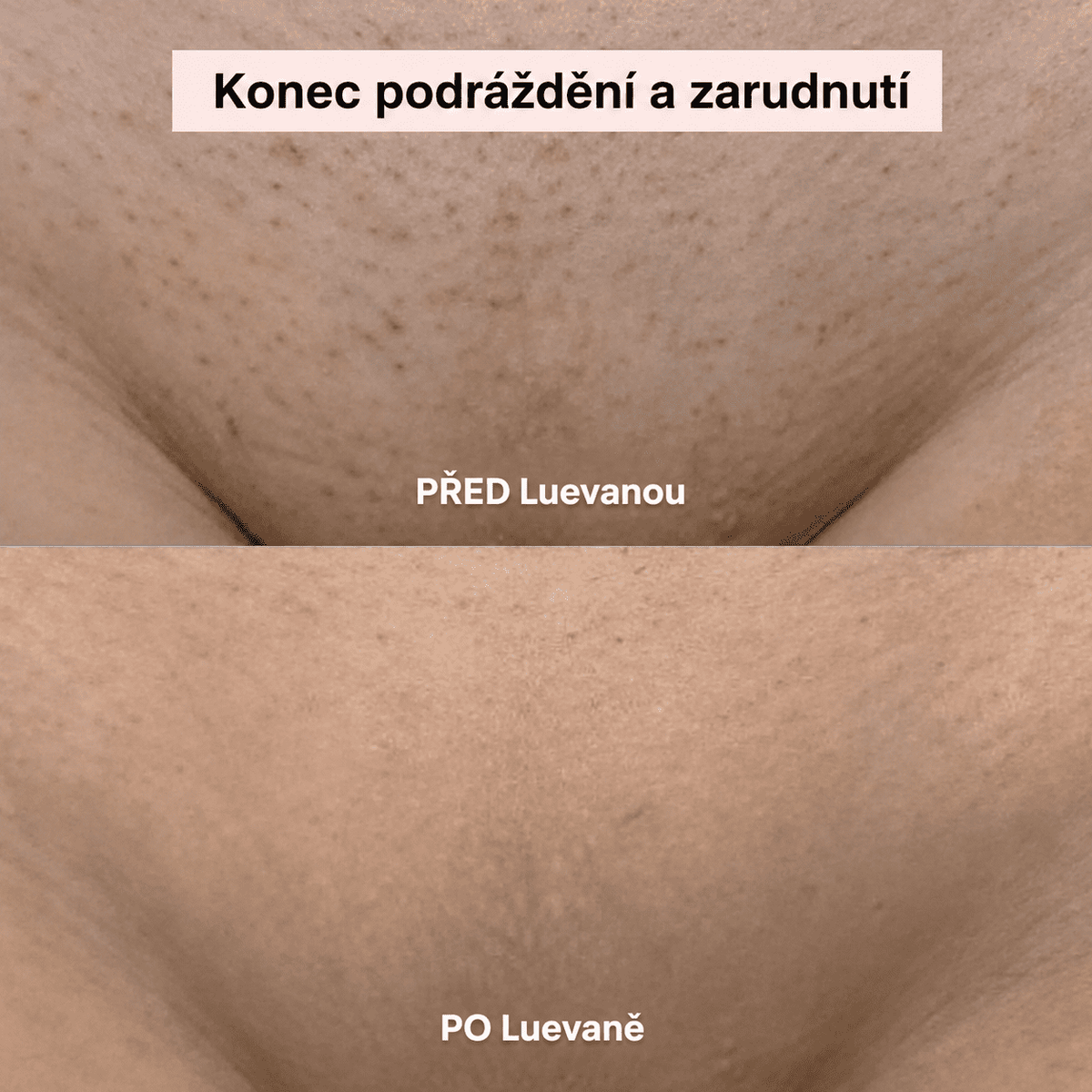 Luevana™ – Dámský holicí strojek 2 v 1